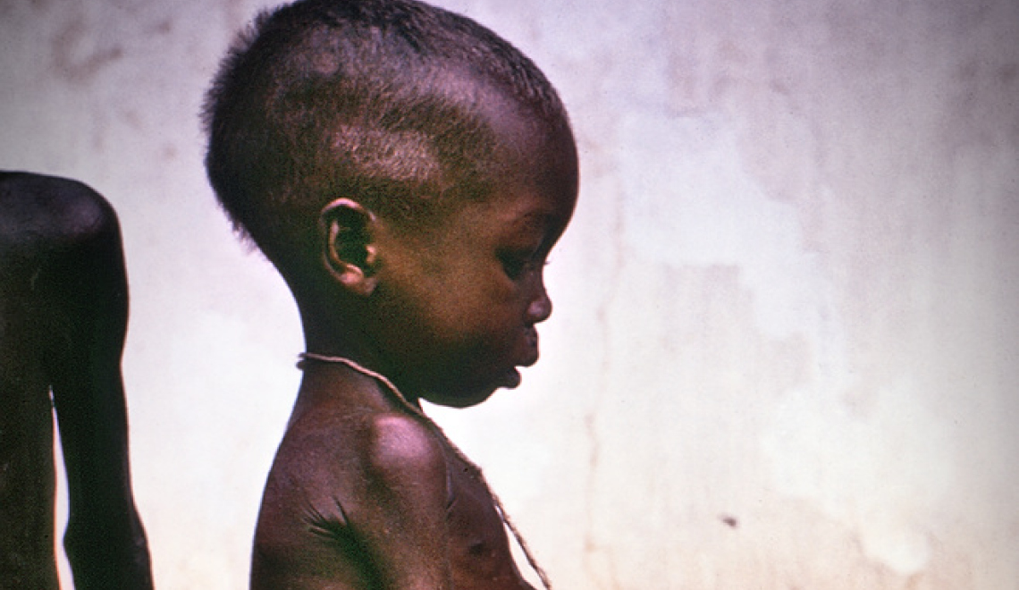 Starved girl Nigeria 1960s - Photo by Dr. Lyle Conrad - from Flickr - PD Abbildung eines nigerianischen Kindes aus den 1960s